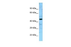 GTPBP5 Rabbit anti-Human, Polyclonal, Novus Biologicals 0.1 mL | Buy Online | Novus Biologicals | Fisher Scientific